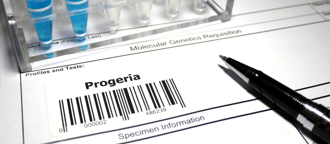 Progéria : comment bloquer la progérine, impliquée dans le vieillissement ? Progéria : comment bloquer la progérine, impliquée dans le vieillissement ?